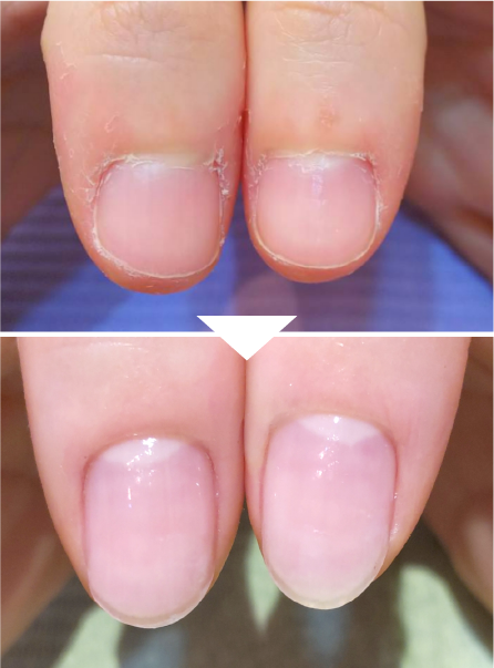 ビフォーアフター画像