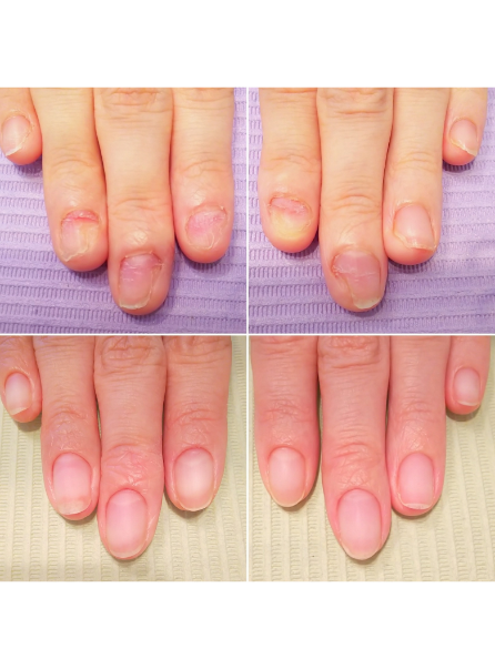 ビフォーアフター画像