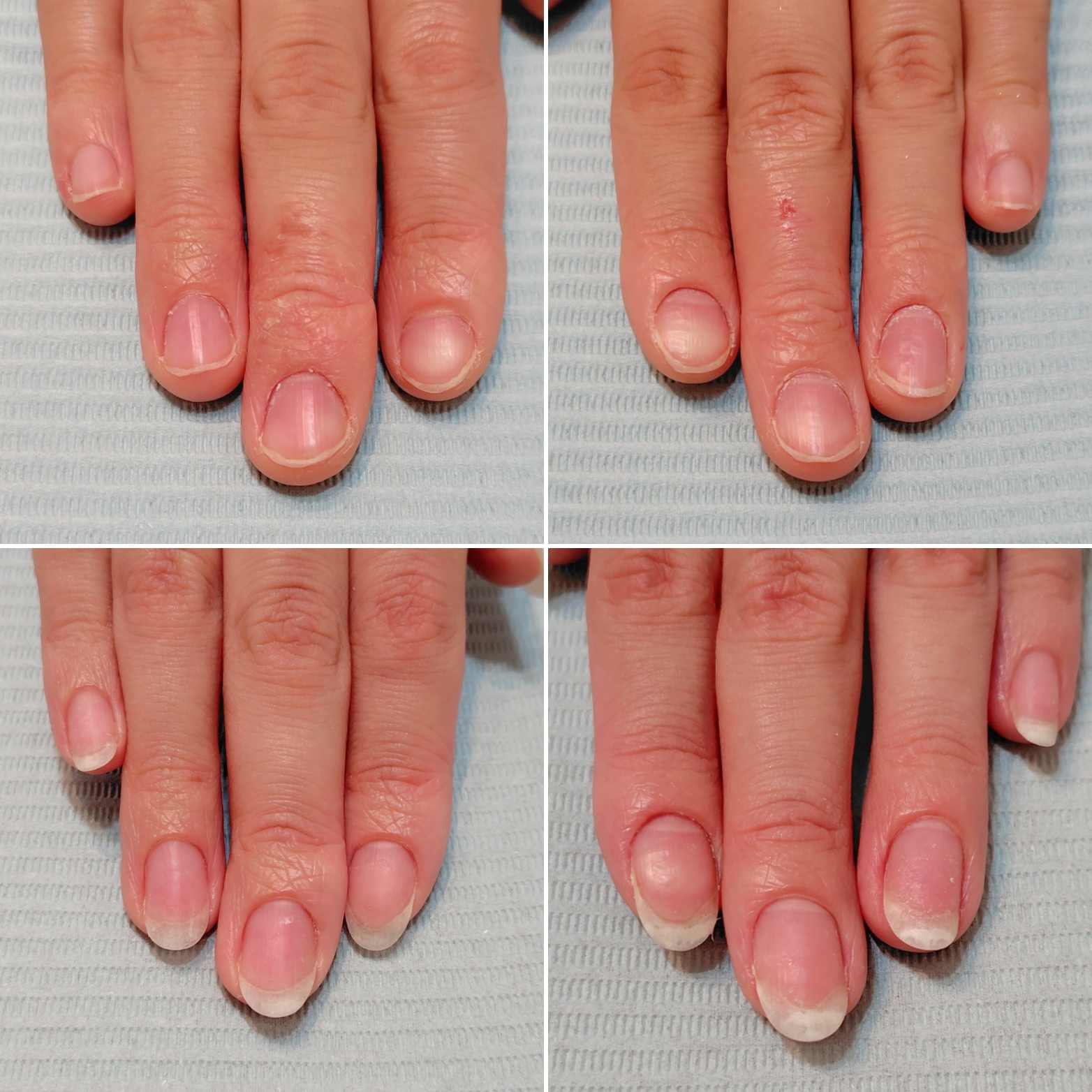 YIさまビフォーアフター画像