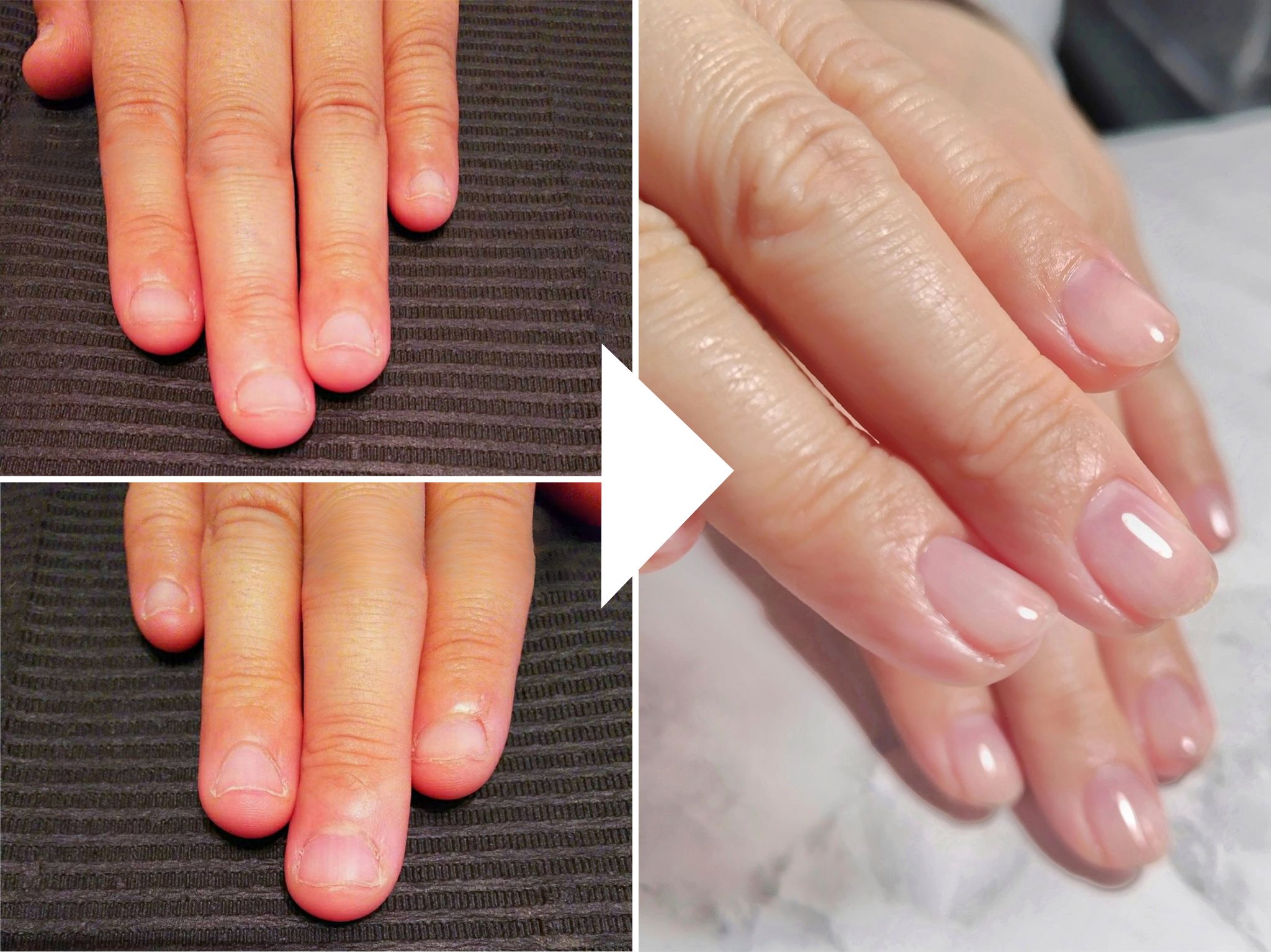 AOさまビフォーアフター画像