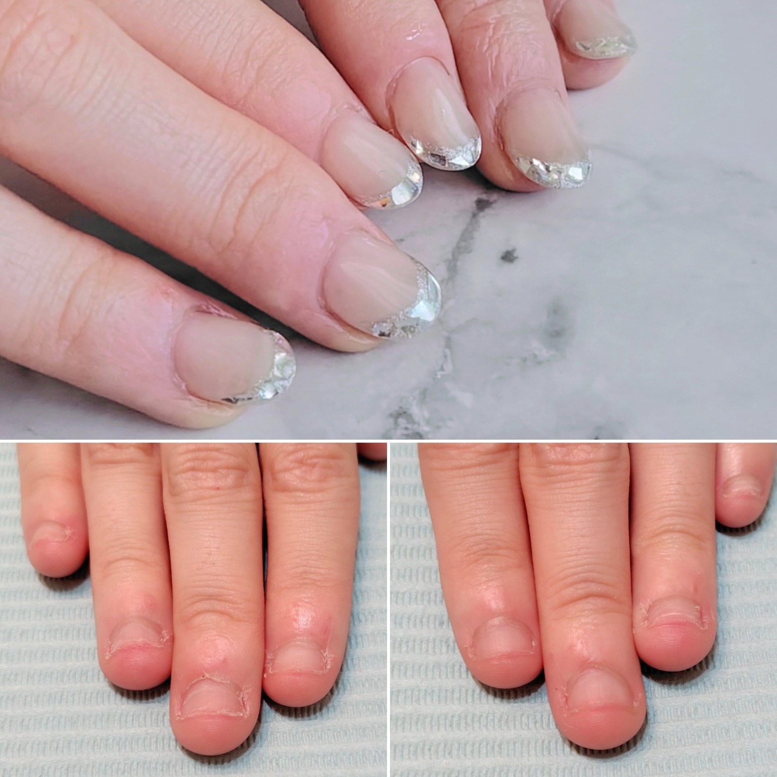 AOさまビフォーアフター画像